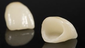 CEREC porcelain crown